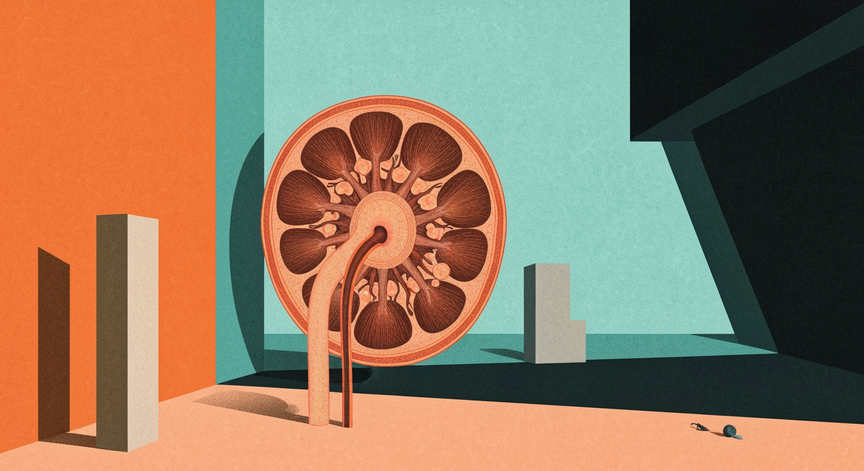 Kidney Failure Explained