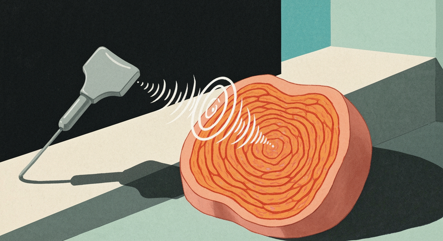 Tissue Harmonics in Ultrasound