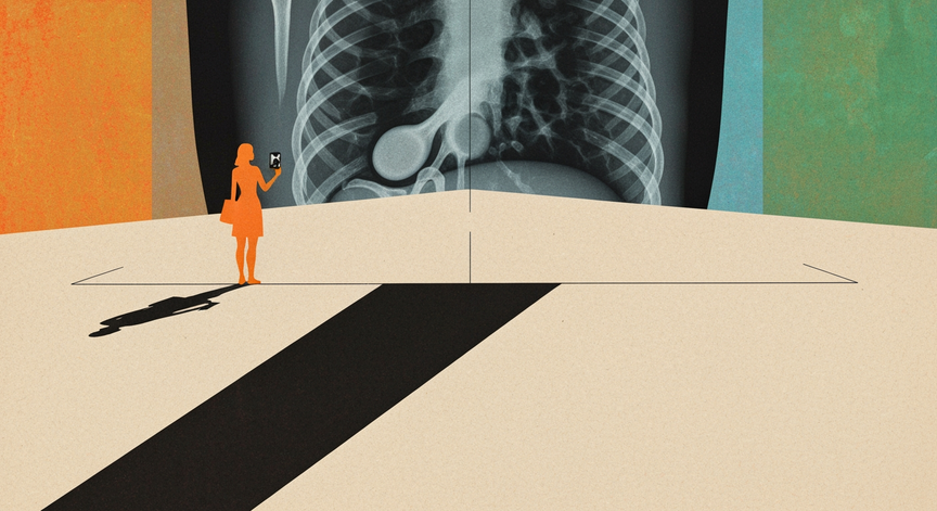 Radiography for Cholecystitis