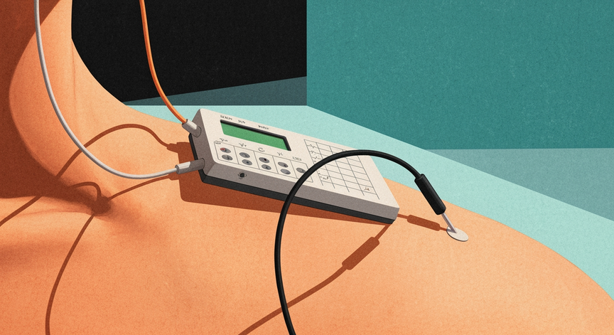 EKG Interpretation Fundamentals