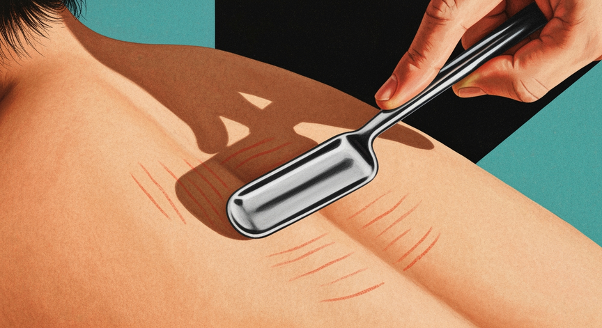 Fascia Scraping Techniques