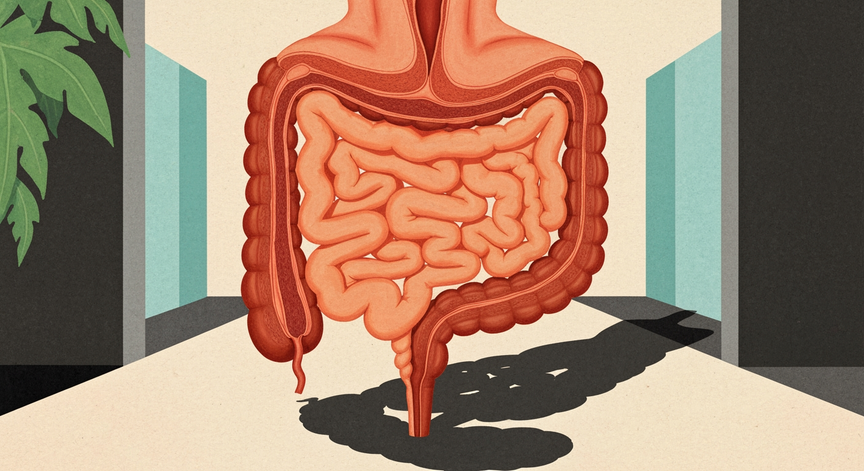 Understanding Irritable Bowel Syndrome