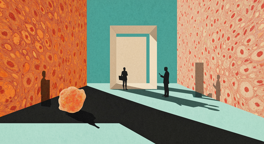 Understanding Ulcerative Colitis