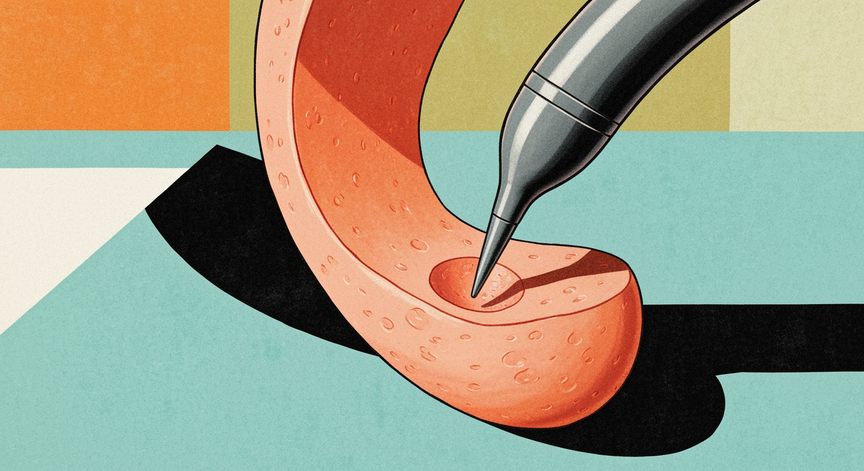 Colonoscopy Procedure Mastery