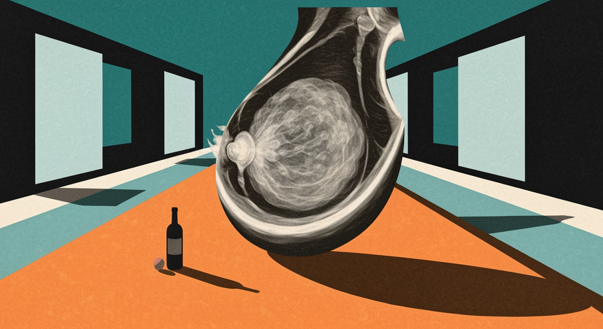 Mammography Explained