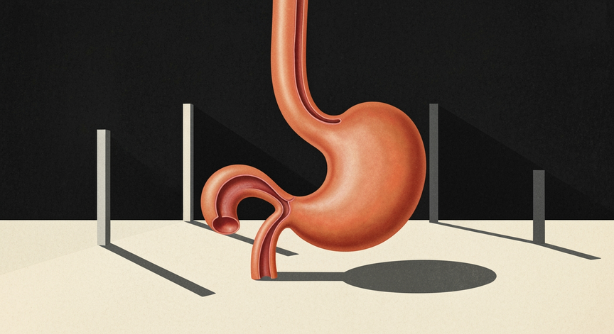 Understanding Acid Reflux