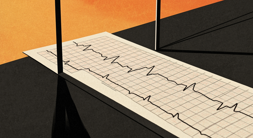 Electrocardiograms Explained