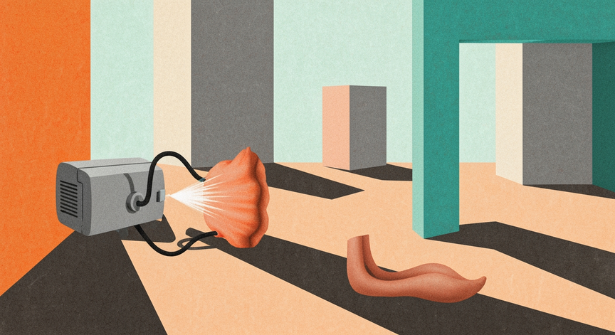 Shockwave Therapy Explained