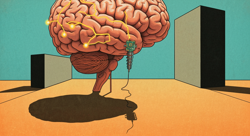 Neural Implants Explained