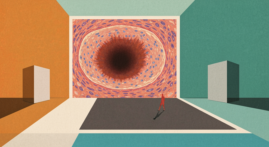 Understanding Peptic Ulcer Disease Pathology
