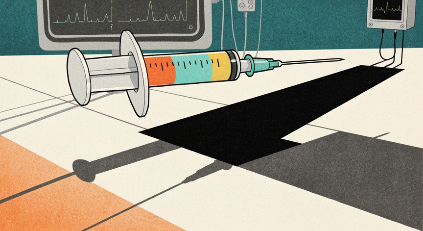Understanding Draw Over Anesthesia Techniques