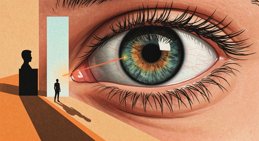LASIK Surgery Explained