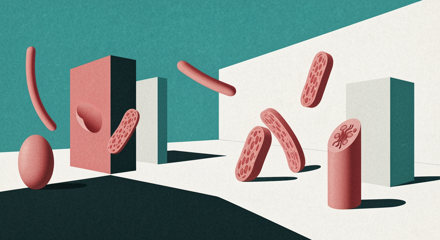 Endometriose Vertiefung und Management