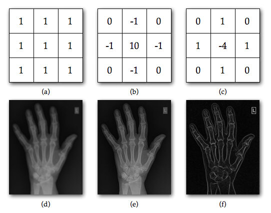 Lesson image