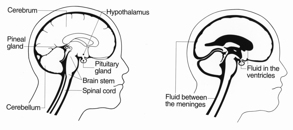 Lesson image