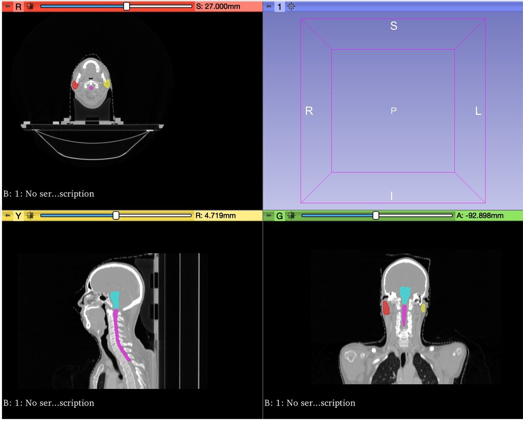 Lesson image
