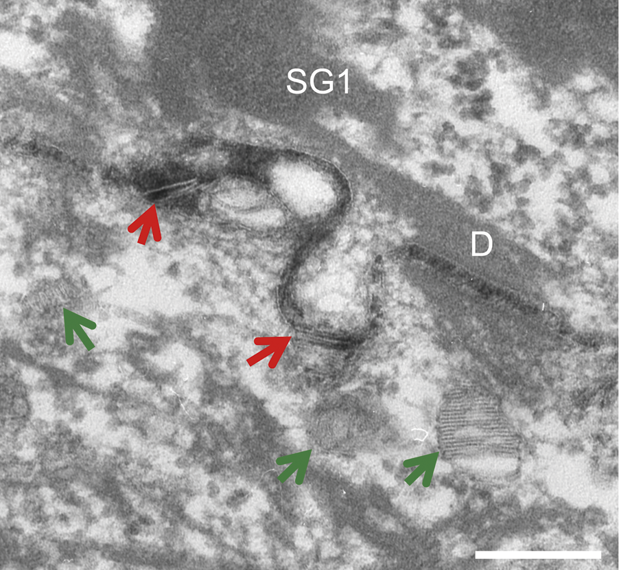 Lesson image