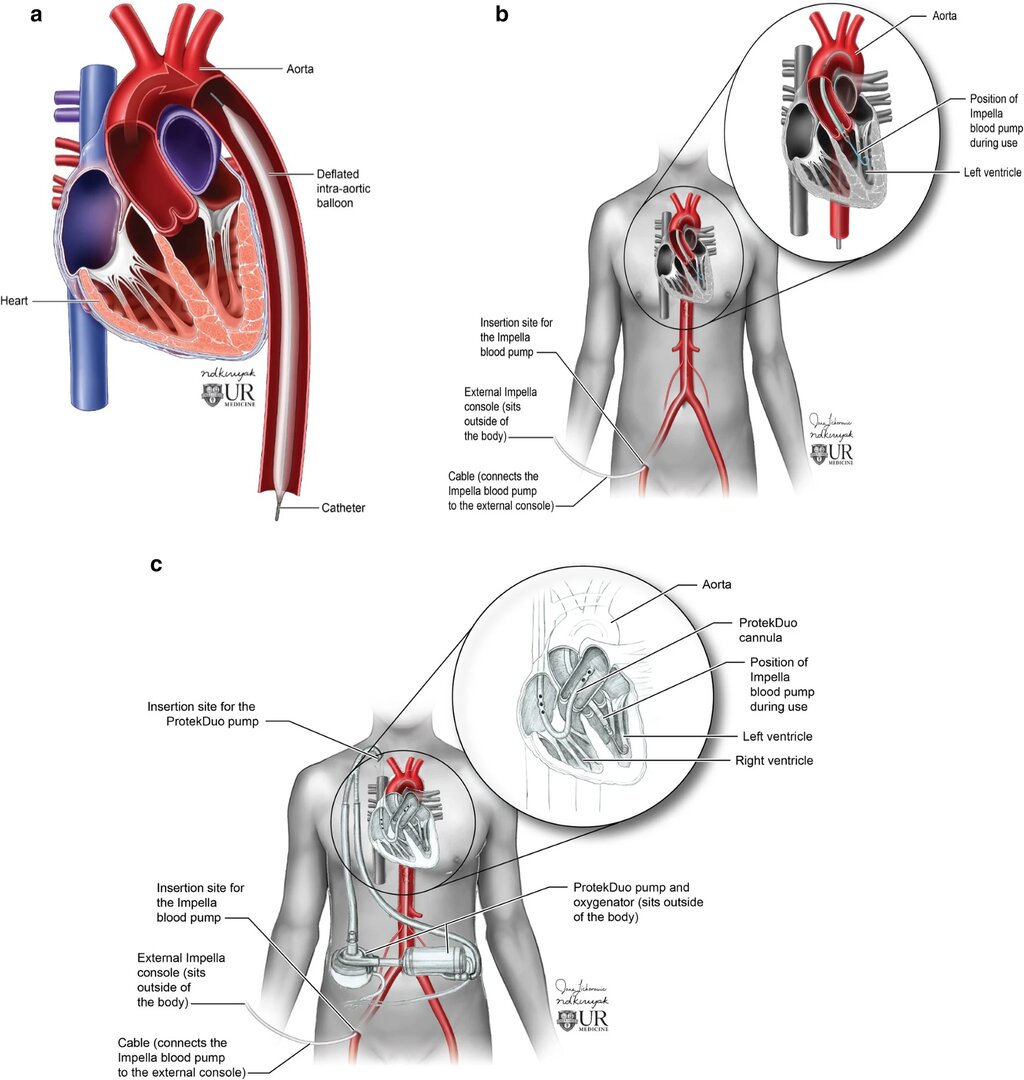 Lesson image