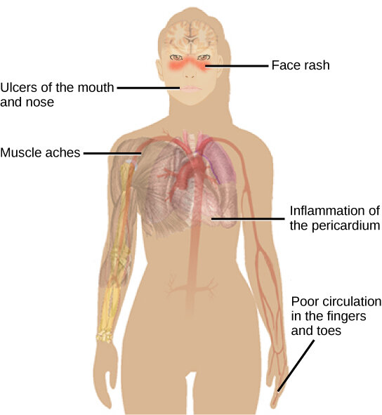 Lesson image