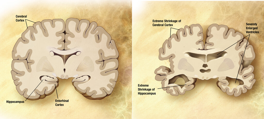 Lesson image