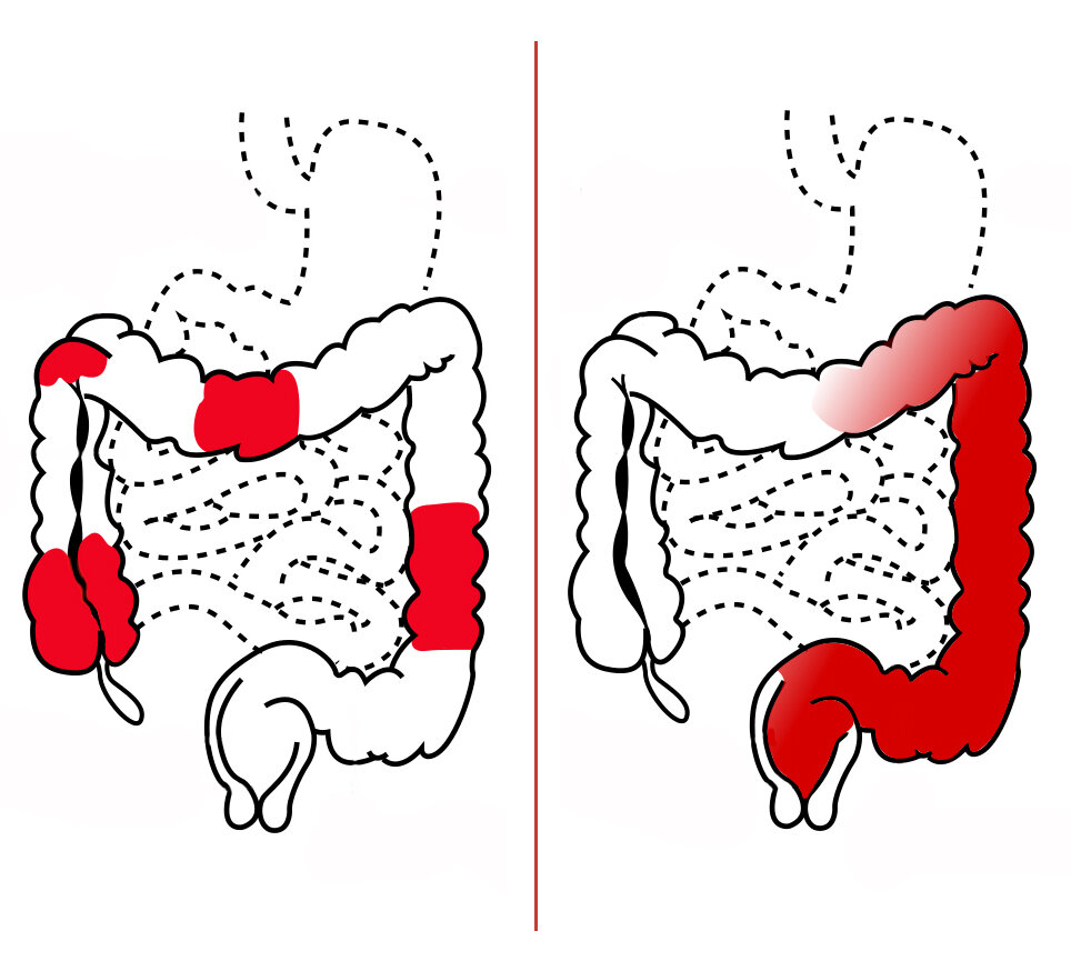 Lesson image