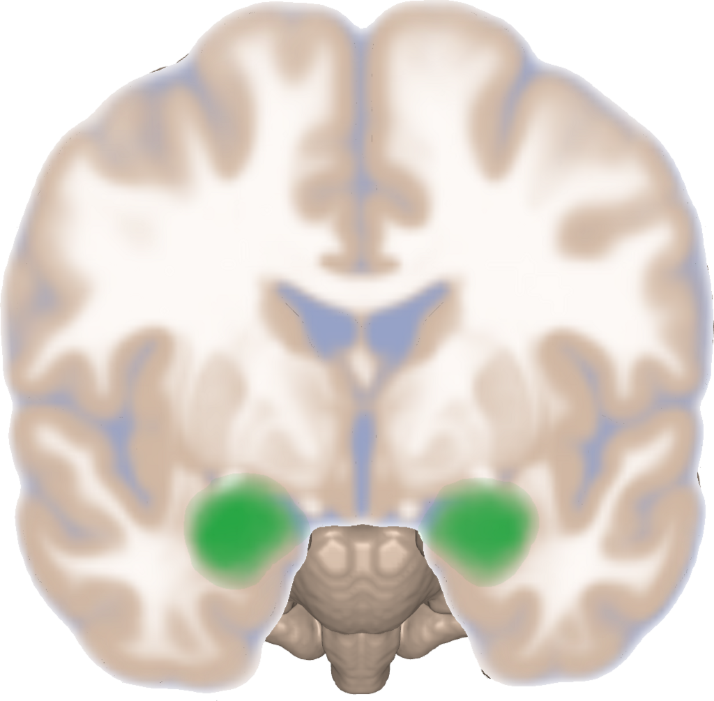 Lesson image