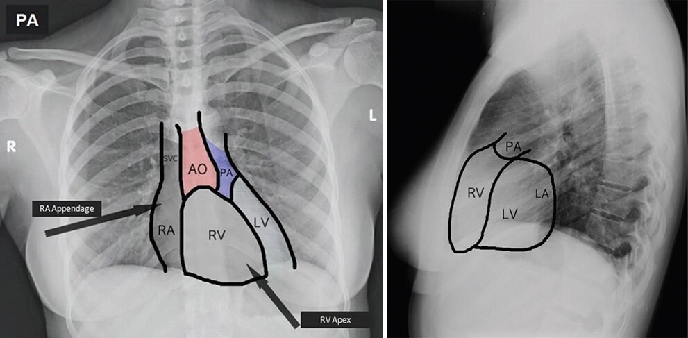 Lesson image