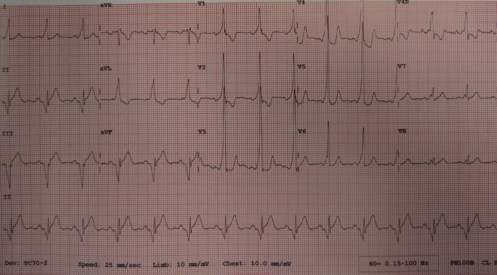 Lesson image