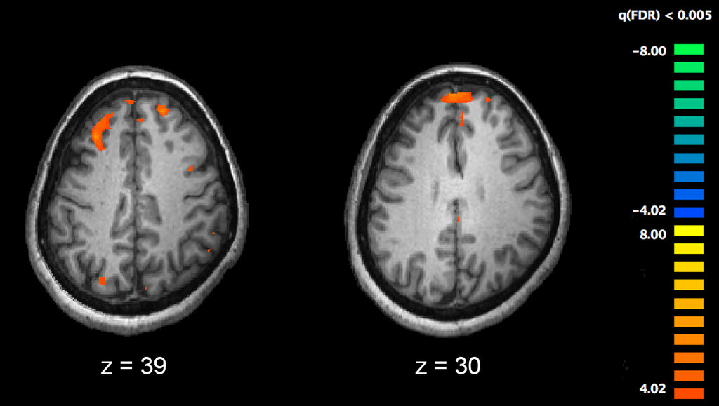 Lesson image