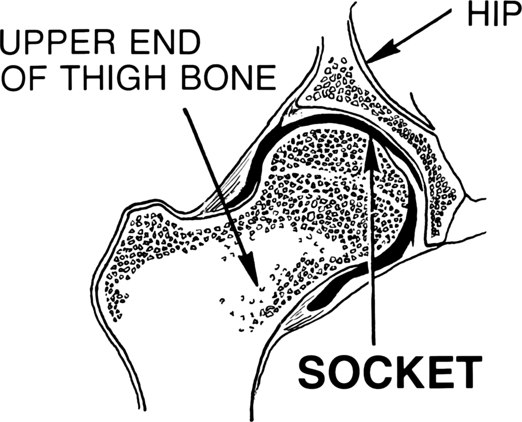 Lesson image