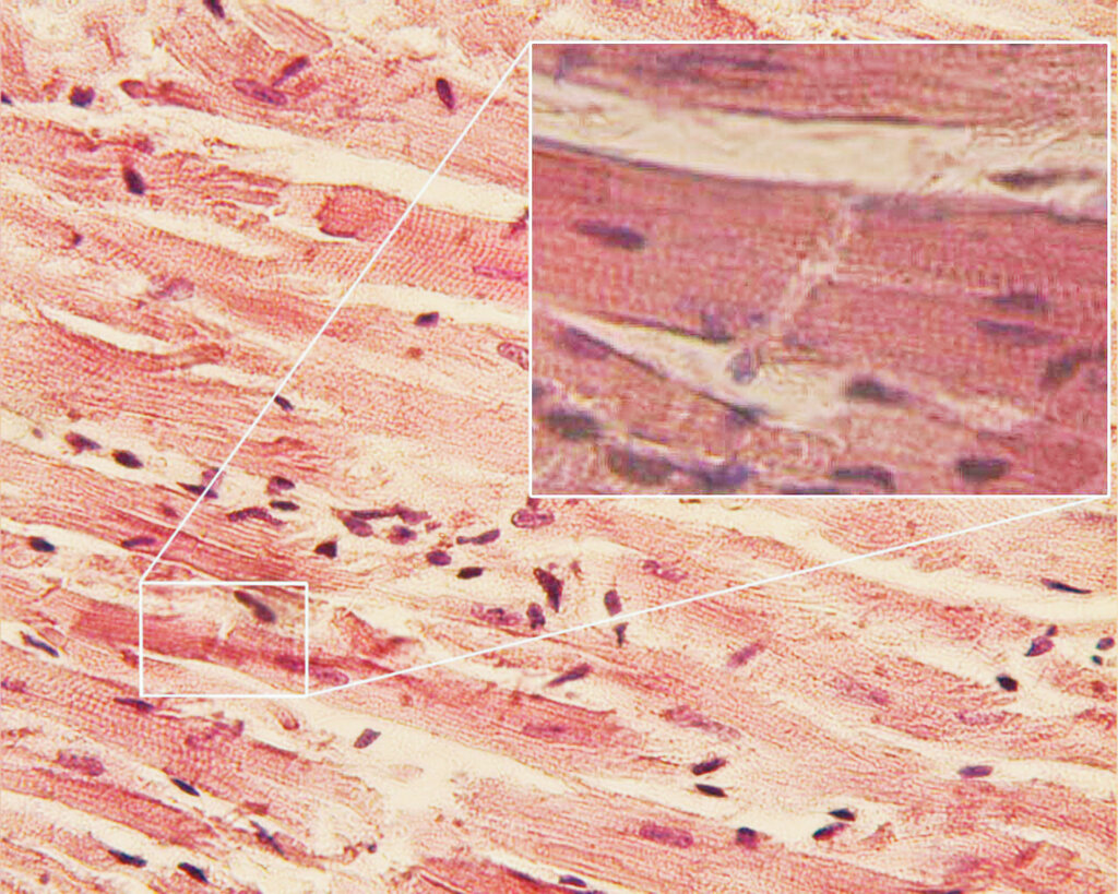 Lesson image