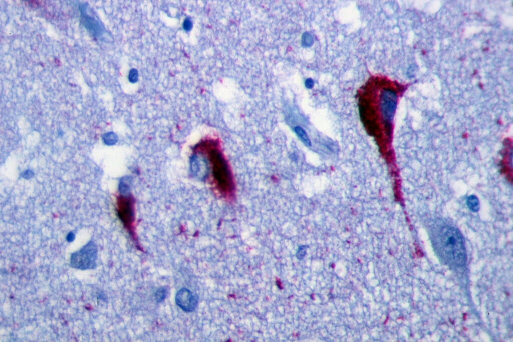 Lesson image