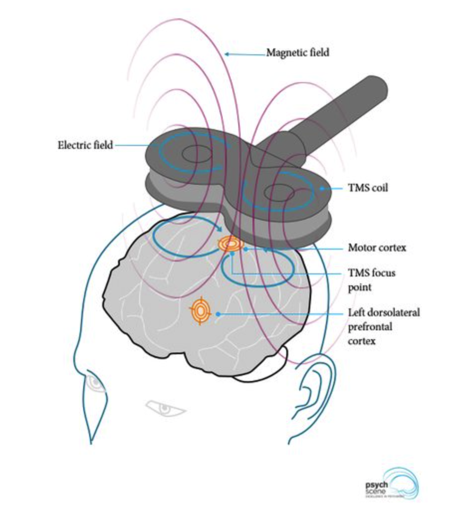 Lesson image