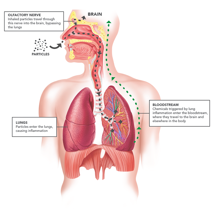 Lesson image