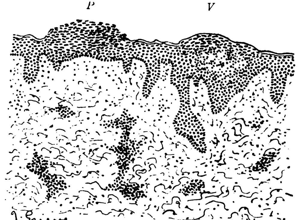 Lesson image