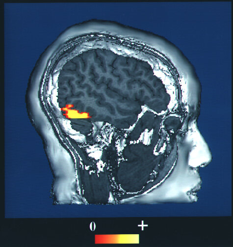 Lesson image