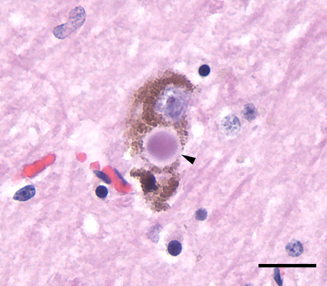 Lesson image