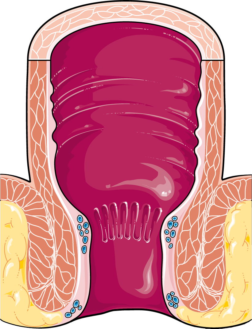 Lesson image