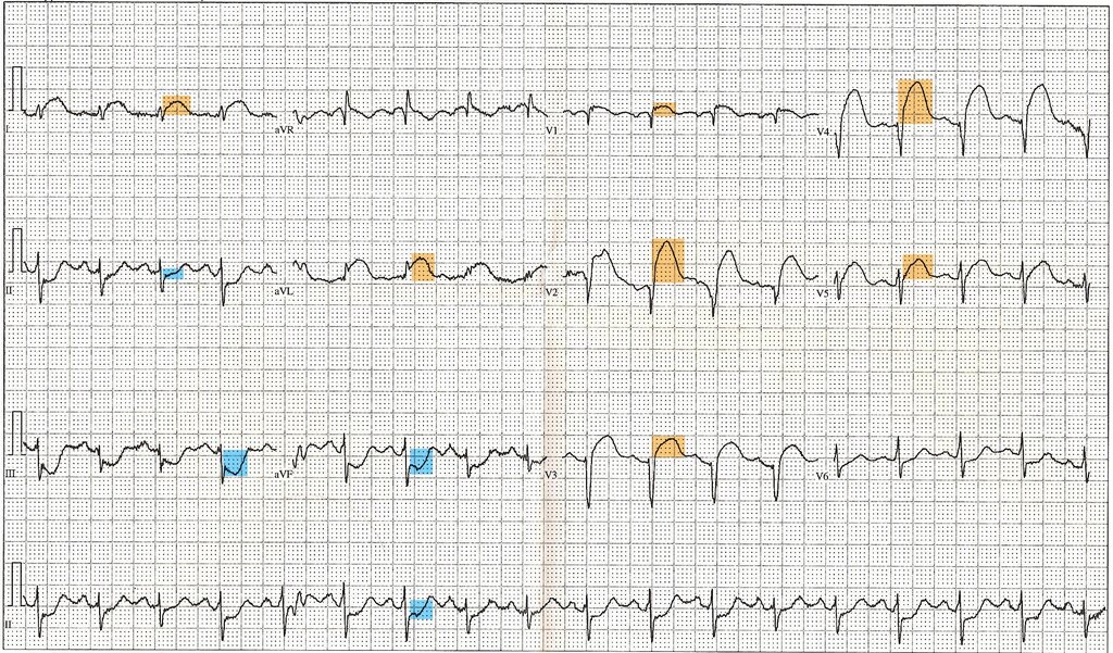 Lesson image