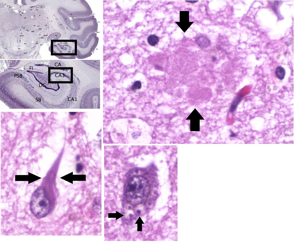Lesson image