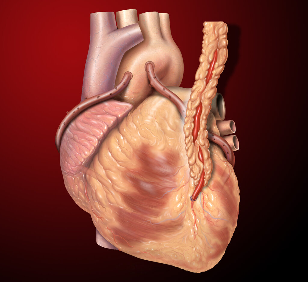 Lesson image