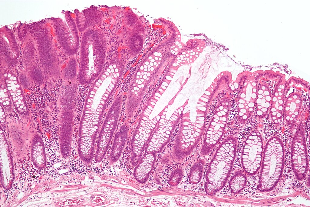 Lesson image