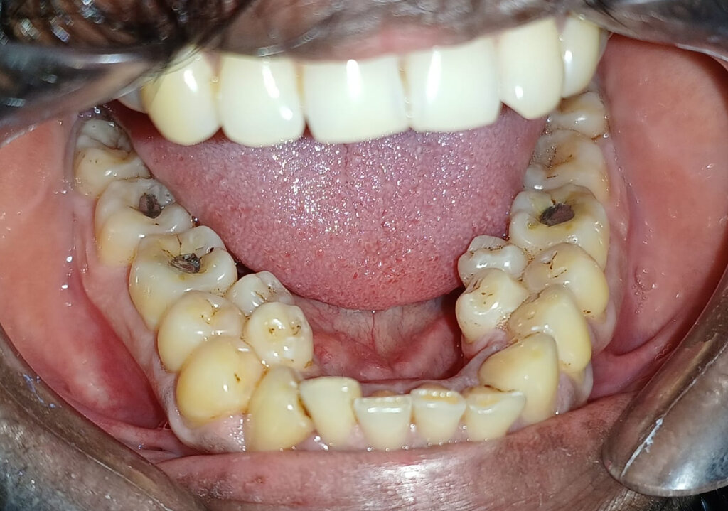 Lesson image