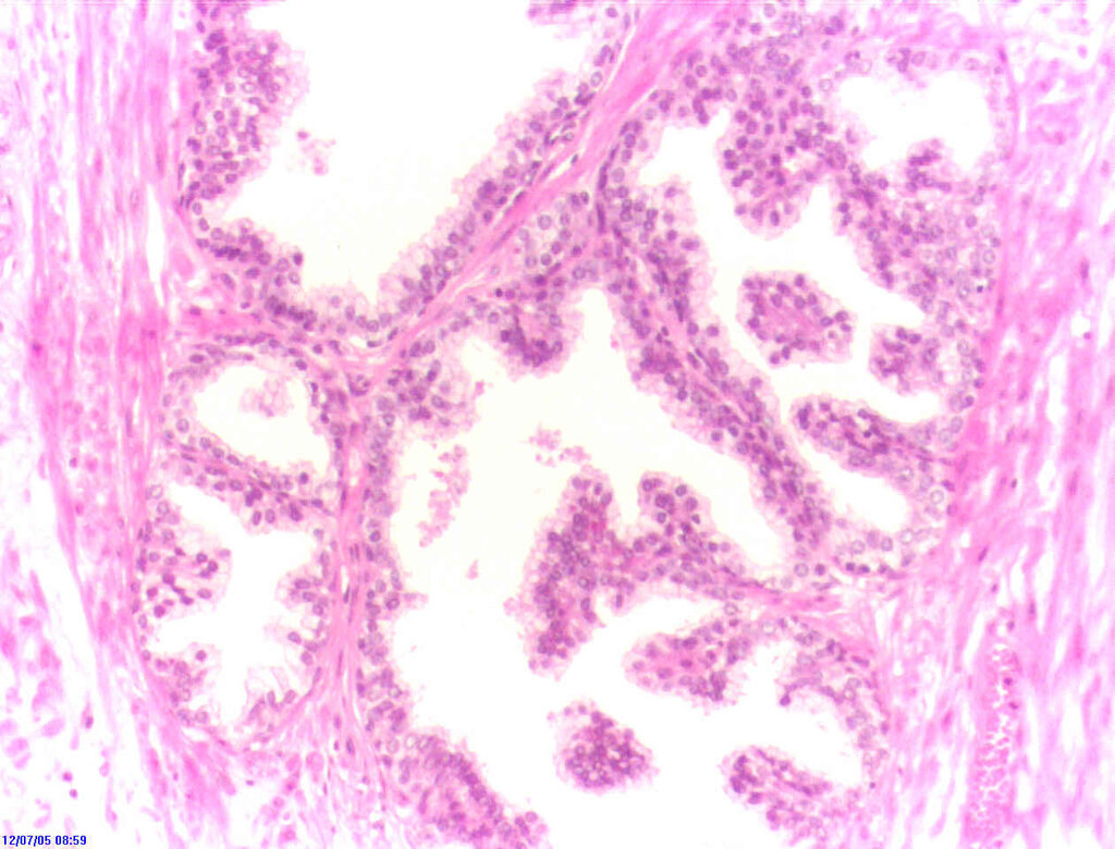 Lesson image