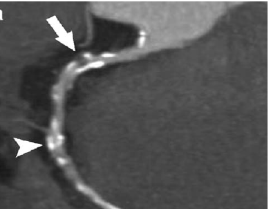 Lesson image