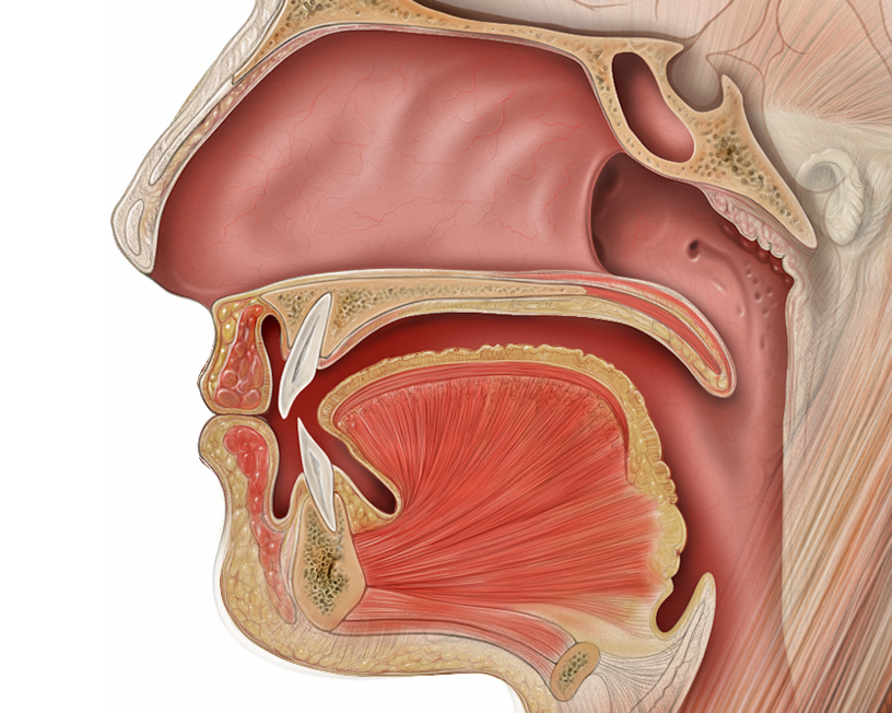 Lesson image