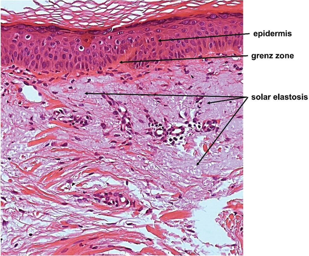 Lesson image