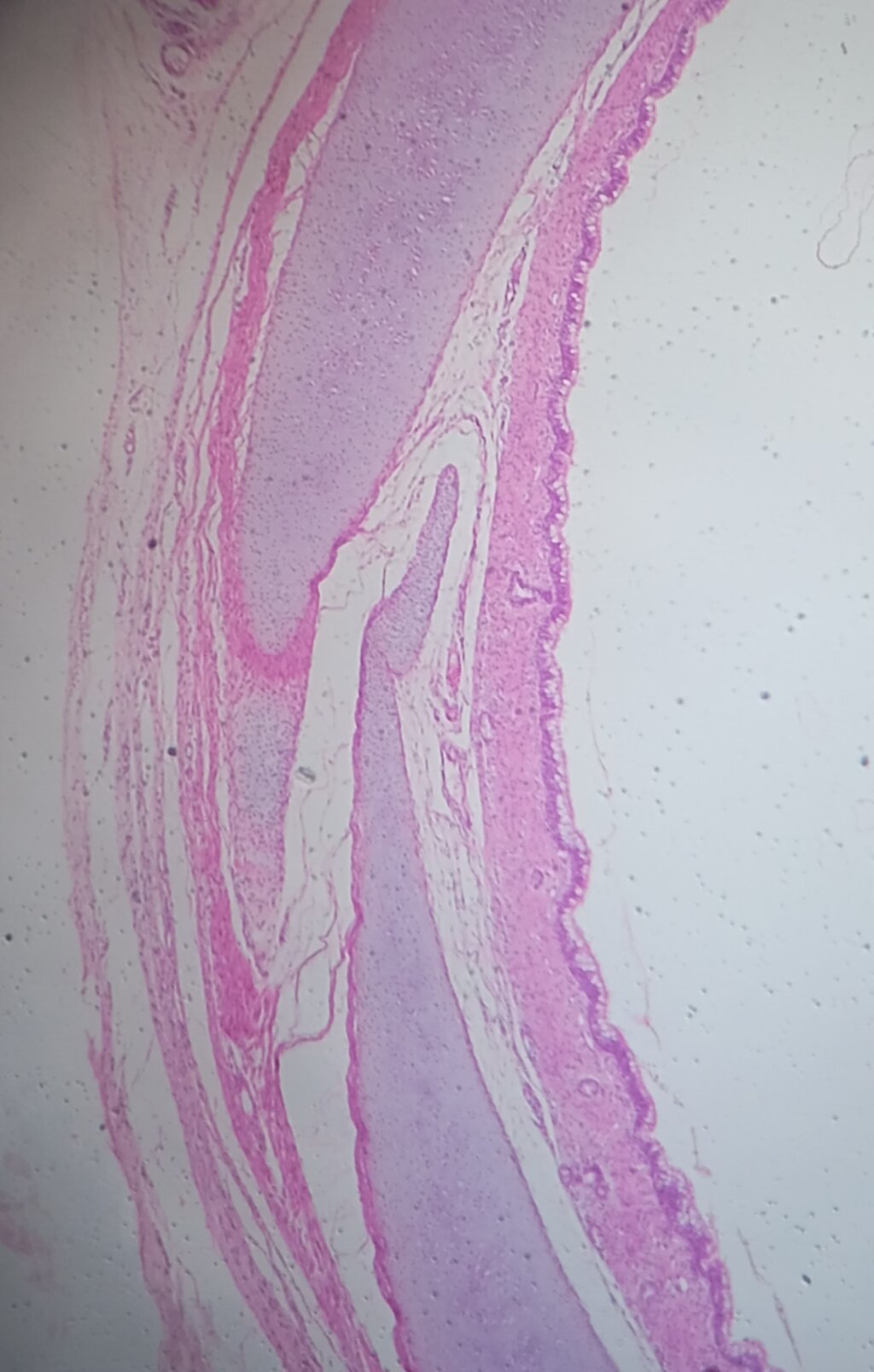 Lesson image