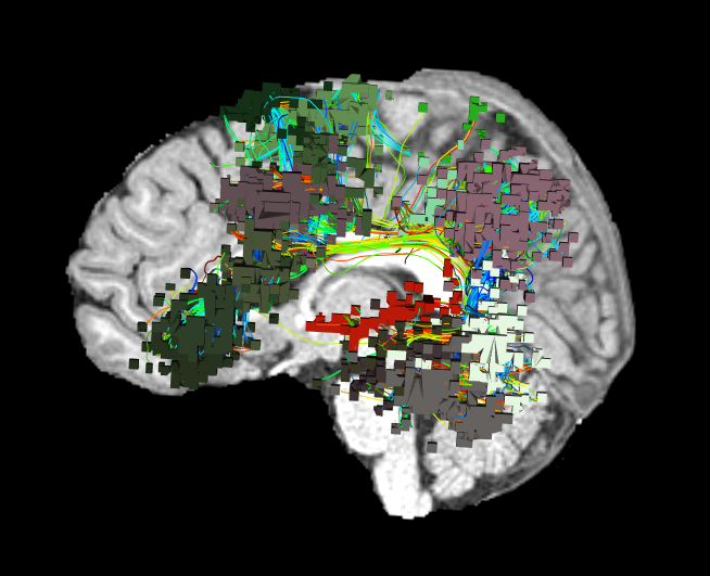 Lesson image