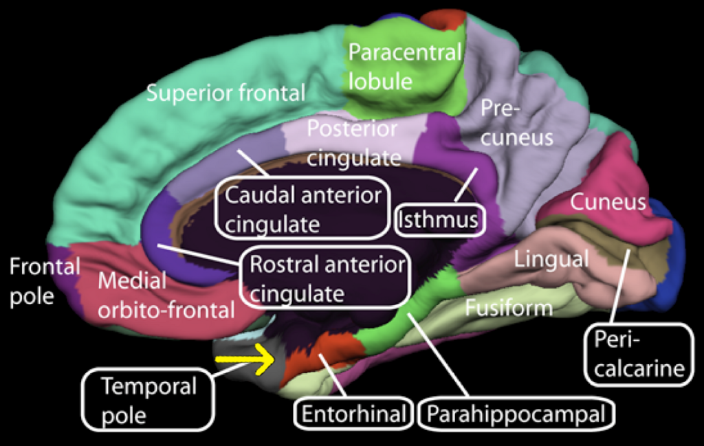 Lesson image